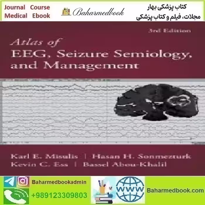Atlas of EEG Seizure Semiology and Management 2022 TRUE P