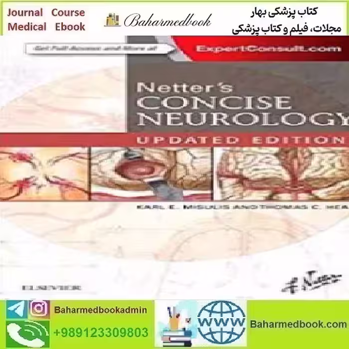 Netter's Concise Neurology 2017 TRUE PDF price 1€ - کتاب پزشکی بهار