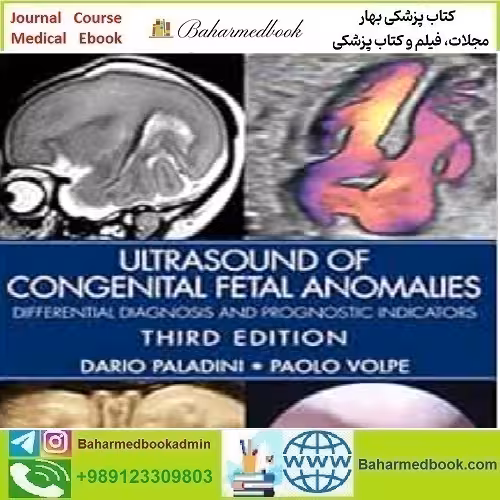 Ultrasound Of Congenital Fetal Anomalies Differential Diagn