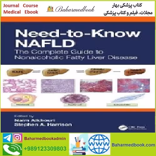 Need to Know NAFLD TRUE PDF price 1€ - کتاب پزشکی بهار