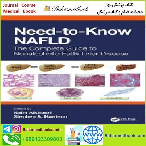 Need to Know NAFLD TRUE PDF price 1€ - کتاب پزشکی بهار
