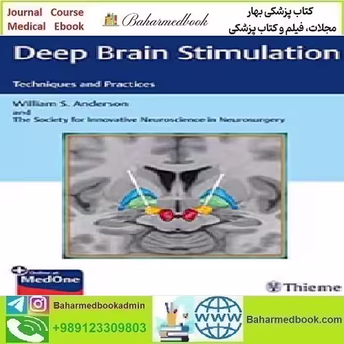 Deep Brain Stimulation Techniques and Practices 2019 TRU