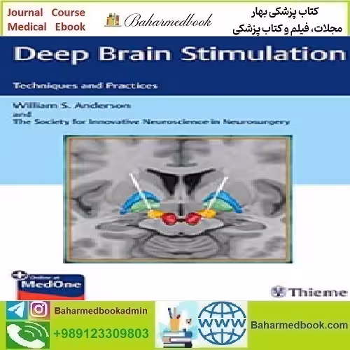 Deep Brain Stimulation Techniques and Practices 2019 TRU