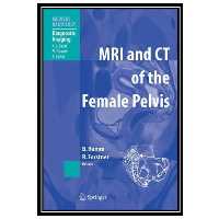 کتاب MR Imaging in White Matter Diseases of the Brain and Spinal Cord اثر جمعی از نویسندگان انتشارات مؤلفین طلایی