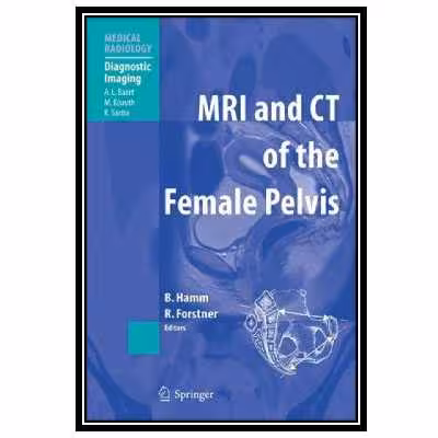 کتاب MR Imaging in White Matter Diseases of the Brain and Spinal Cord اثر جمعی از نویسندگان انتشارات مؤلفین طلایی