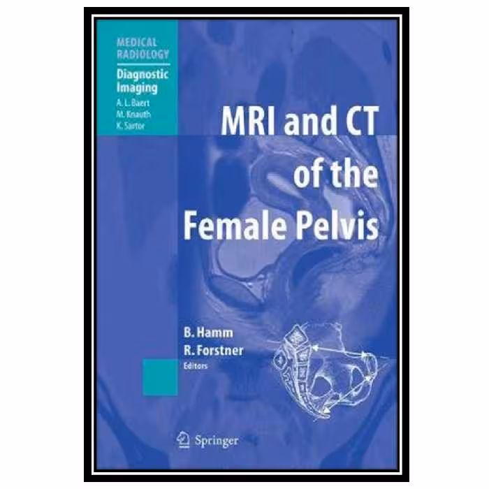 کتاب MR Imaging in White Matter Diseases of the Brain and Spinal Cord اثر جمعی از نویسندگان انتشارات مؤلفین طلایی