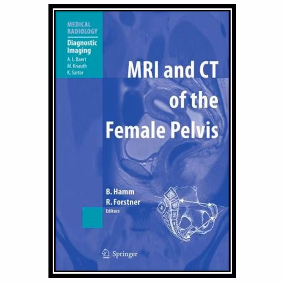 کتاب MR Imaging in White Matter Diseases of the Brain and Spinal Cord اثر جمعی از نویسندگان انتشارات مؤلفین طلایی