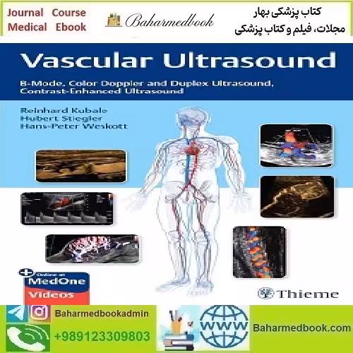 Vascular Ultrasound B Mode Color