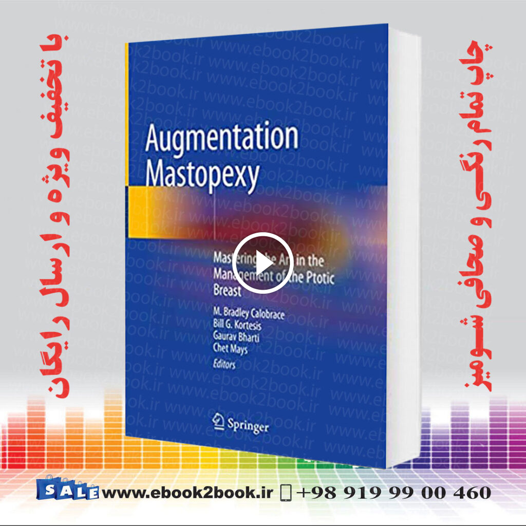 Augmentation Mastopexy