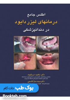 اطلس جامع درمان های لیزر دایود در دندانپزشکی