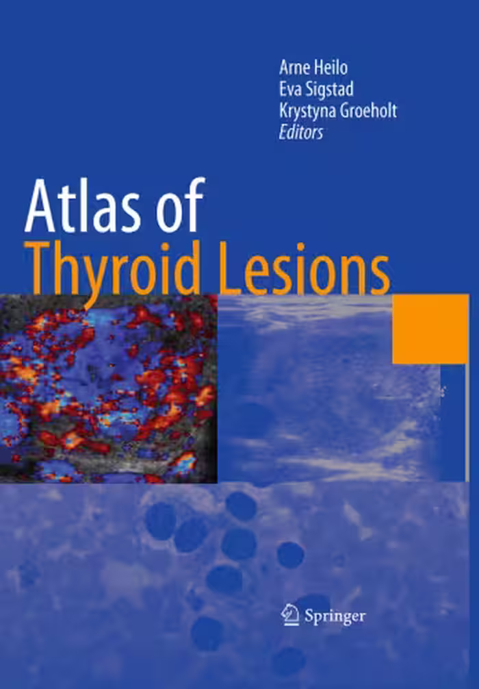 خرید و دانلود نسخه کامل کتاب Atlas of thyroid lesions