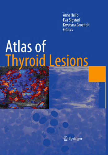 خرید و دانلود نسخه کامل کتاب Atlas of thyroid lesions