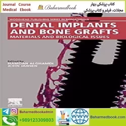 Dental Implants and Bone Grafts 2020 TRUE PDF price 1€ - کتاب پزشکی بهار