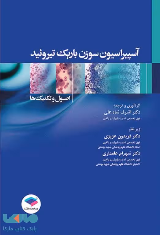آسپیراسیون سوزن باریک تیروئید اصول و تکنیک ها جامعه نگر