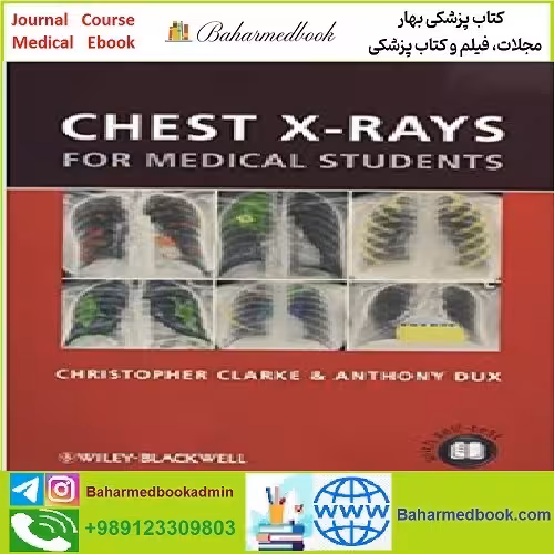 Chest X rays for Medical Students TRUE PDF price 1€ - کتاب پزشکی بهار