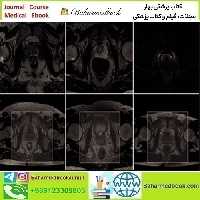 ARRS Pearls and Pitfalls in Prostate and Pelvic Imaging 2021 vi