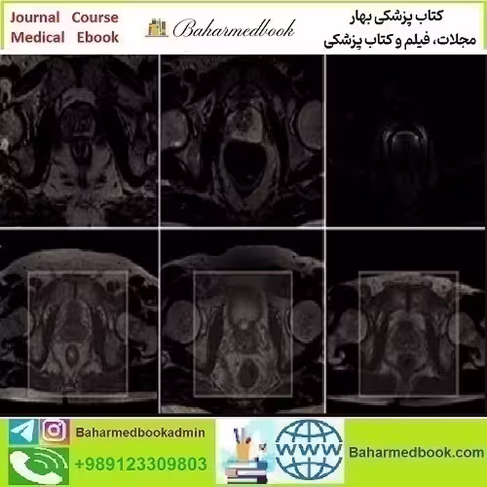 ARRS Pearls and Pitfalls in Prostate and Pelvic Imaging 2021 vi