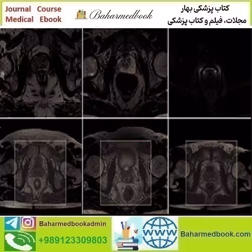 ARRS Pearls and Pitfalls in Prostate and Pelvic Imaging 2021 vi
