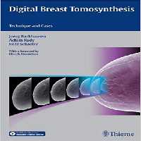 Digital Breast Tomosynthesis: Technique and Cases, 1ed - کتاب پزشکی بهار