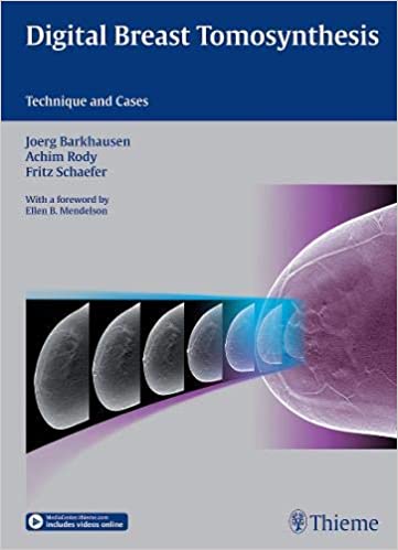 Digital Breast Tomosynthesis: Technique and Cases, 1ed - کتاب پزشکی بهار