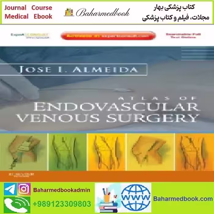 Atlas of Endovascular Venous Surgery Expert Consult TRUE PD