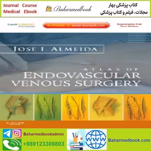 Atlas of Endovascular Venous Surgery Expert Consult TRUE PD