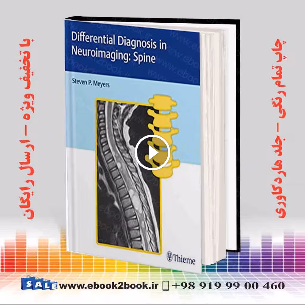 Differential Diagnosis in Neuroimaging : Spine