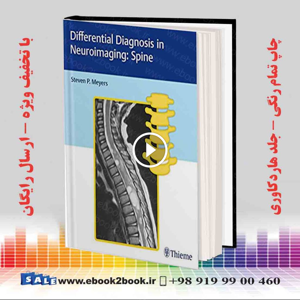 Differential Diagnosis in Neuroimaging : Spine