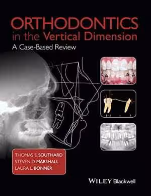 [PDF] دانلود کتاب Orthodontics In The Vertical Dimension - A Case-Based Review, 2015