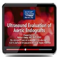 Gulfcoast Ultrasound Evaluation of Aortic Endografts at 15€ - کتاب پزشکی بهار