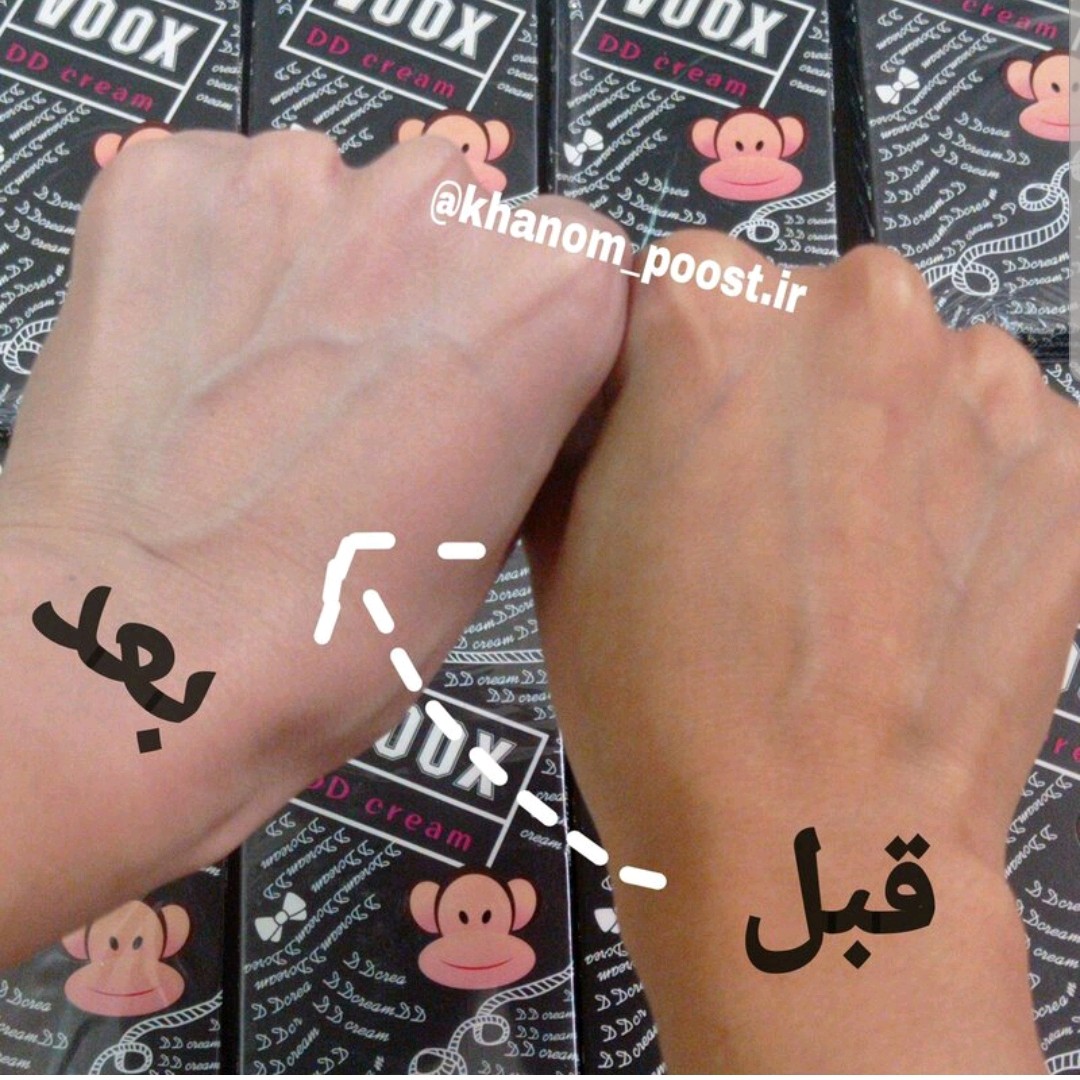 کرم سفید کننده ووکس سفید کننده موقتی(آرایشی هوتران)