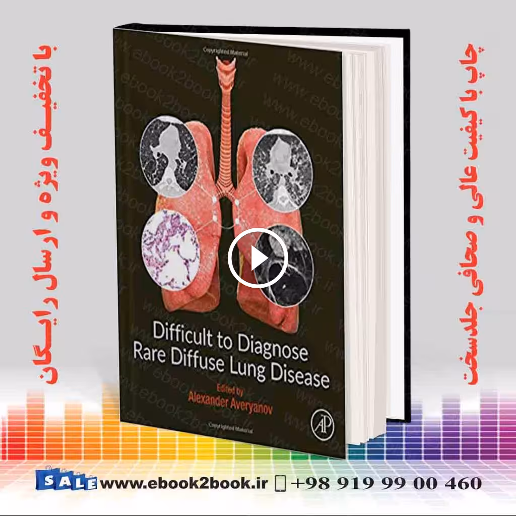 Difficult to Diagnose Rare Diffuse Lung Disease