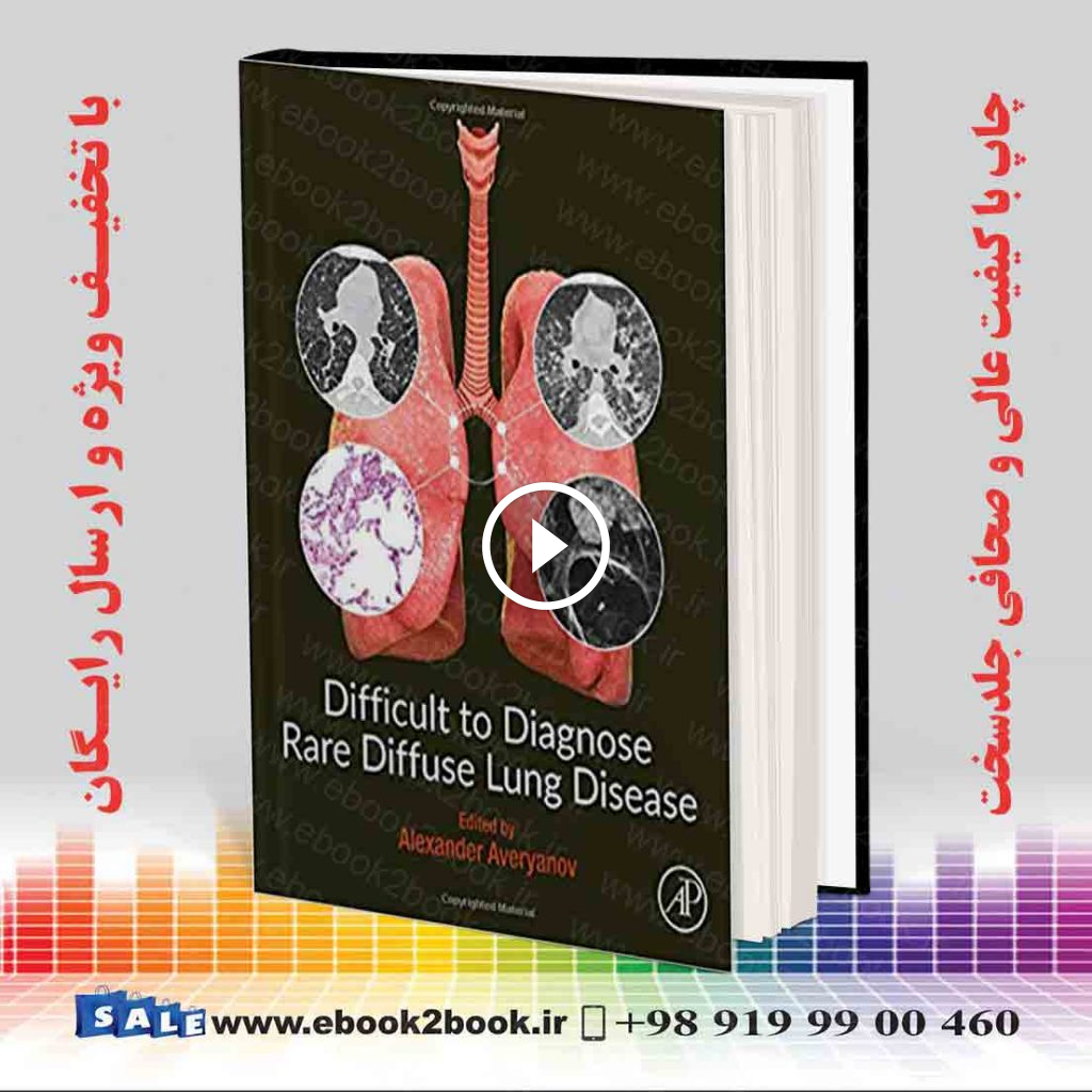 Difficult to Diagnose Rare Diffuse Lung Disease