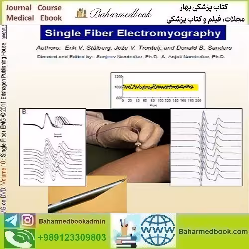 EMG NCS Online Series Volume X Single Fiber Electromyography