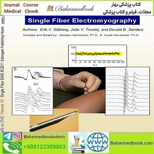 EMG NCS Online Series Volume X Single Fiber Electromyography