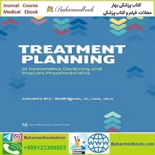 Treatment Planning in Restorative Dentistry and Implant Pros