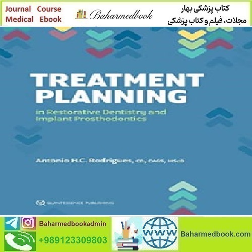 Treatment Planning in Restorative Dentistry and Implant Pros