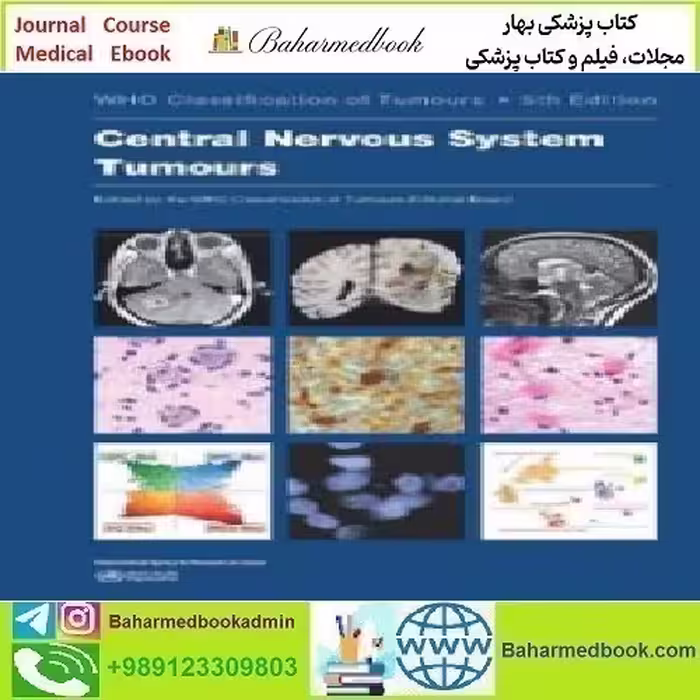 Central Nervous System Tumours WHO Classification of Tumours 2