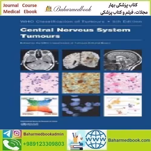 Central Nervous System Tumours WHO Classification of Tumours 2