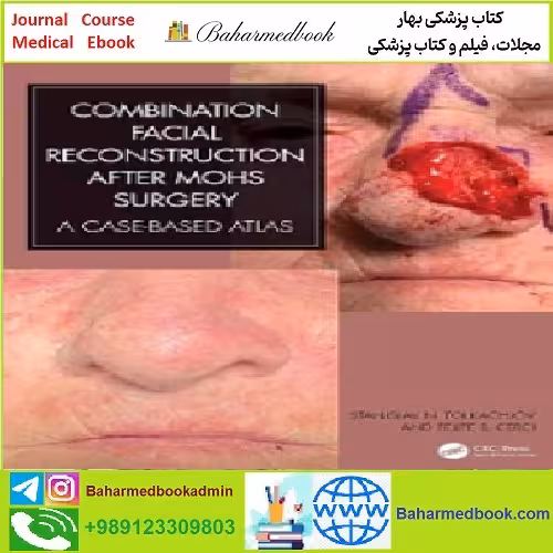 Combination Facial Reconstruction after Mohs Surgery TRUE PD