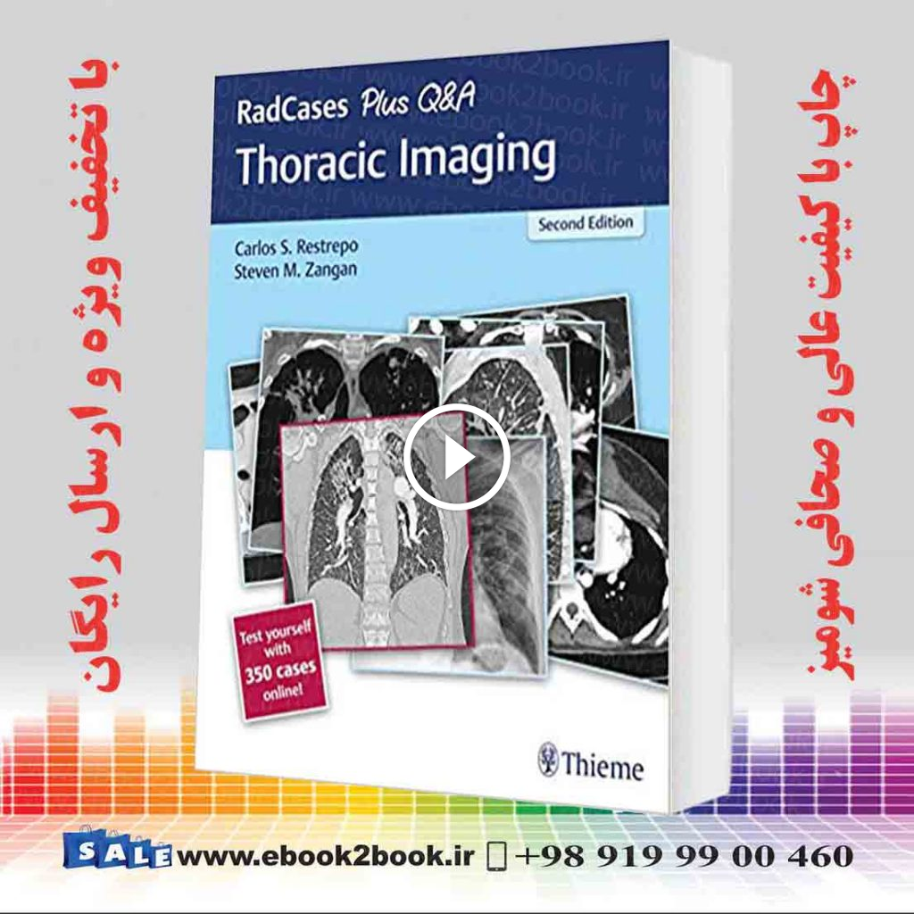 RadCases Plus QandA Thoracic Imaging 2nd Edition