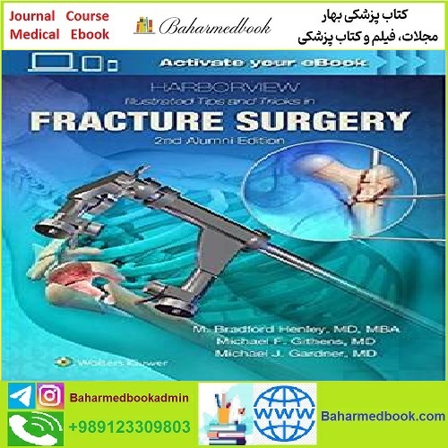 Harborview Illustrated Tips and Tricks in Fracture Surgery T