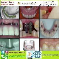 A Z in Restorative Implant Dentistry Series video course price 36€ - کتاب پزشکی بهار