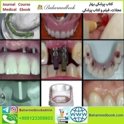A Z in Restorative Implant Dentistry Series video course price 36€ - کتاب پزشکی بهار