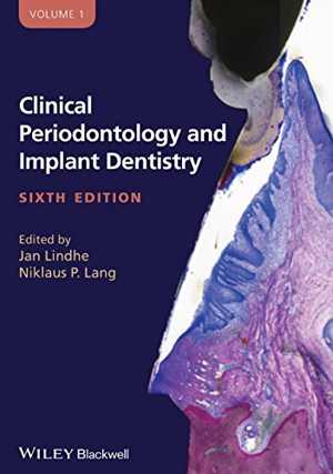 [PDF] دانلود کتاب Clinical Periodontology And Implant Dentistry, 2 Volume Set, 6th ed, 2015