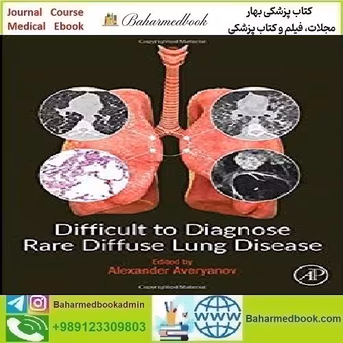Difficult to Diagnose Rare Diffuse Lung Disease 2020
