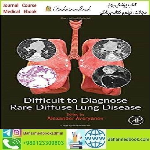 Difficult to Diagnose Rare Diffuse Lung Disease 2020