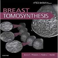 Breast Tomosynthesis - کتاب پزشکی بهار