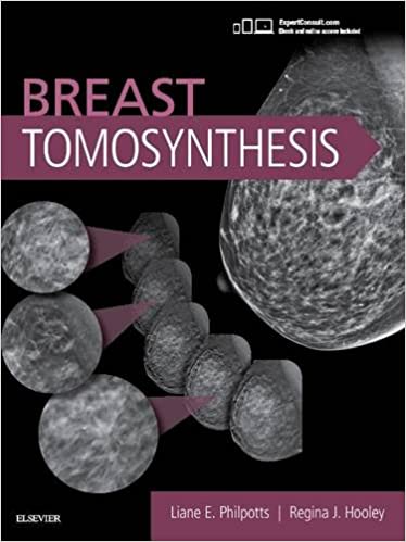 Breast Tomosynthesis - کتاب پزشکی بهار