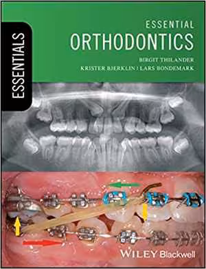 [PDF] دانلود کتاب Essential Orthodontics, 2018